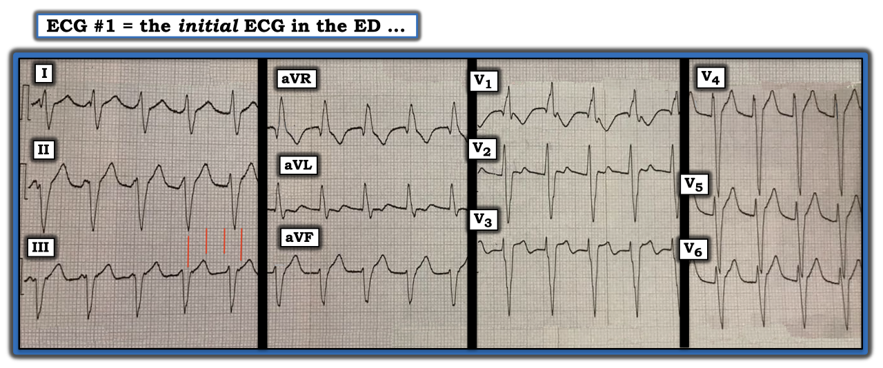 ECG Review December 15 IM