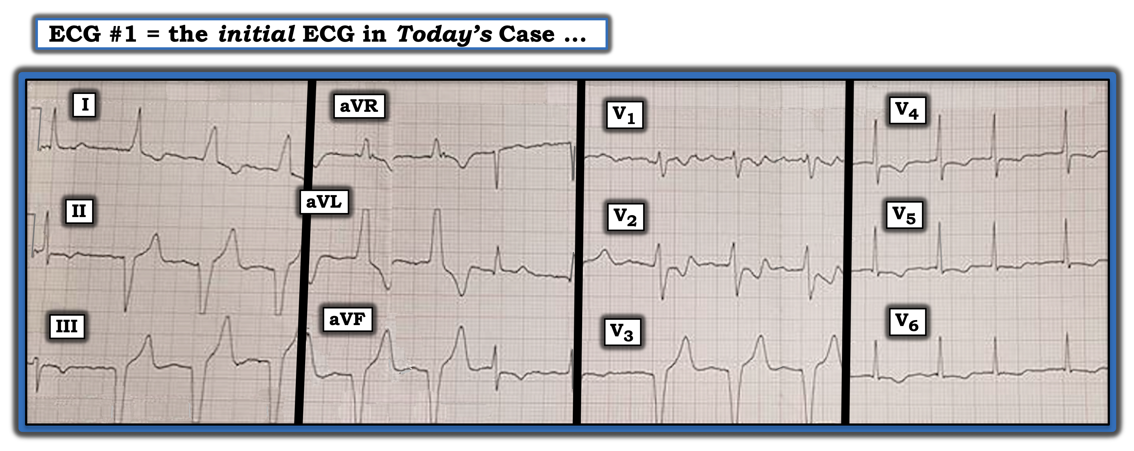 May 15 2023 IM ECG Review
