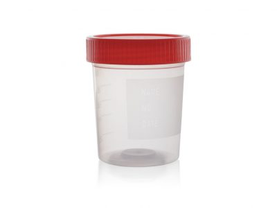 Specimen collection container Getty Images 1186937374