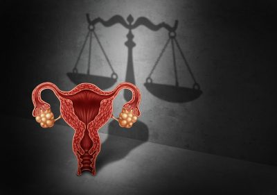 Abortion post Dobbs Getty Images 1150430705