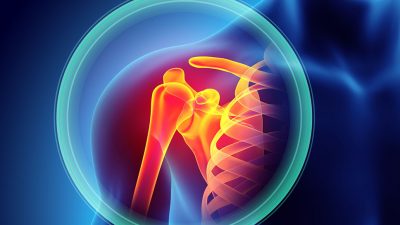 Shoulder injury Getty Images 592653816