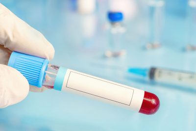 Test tube with blood sample Getty Images 1388921662