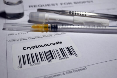 Cryptococcosis Getty Images 1128842330