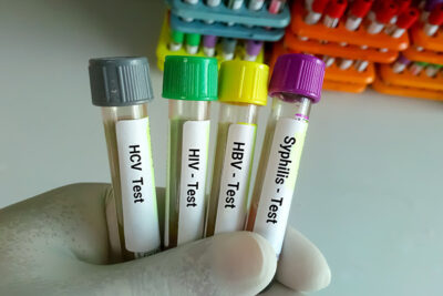 STI Tests
