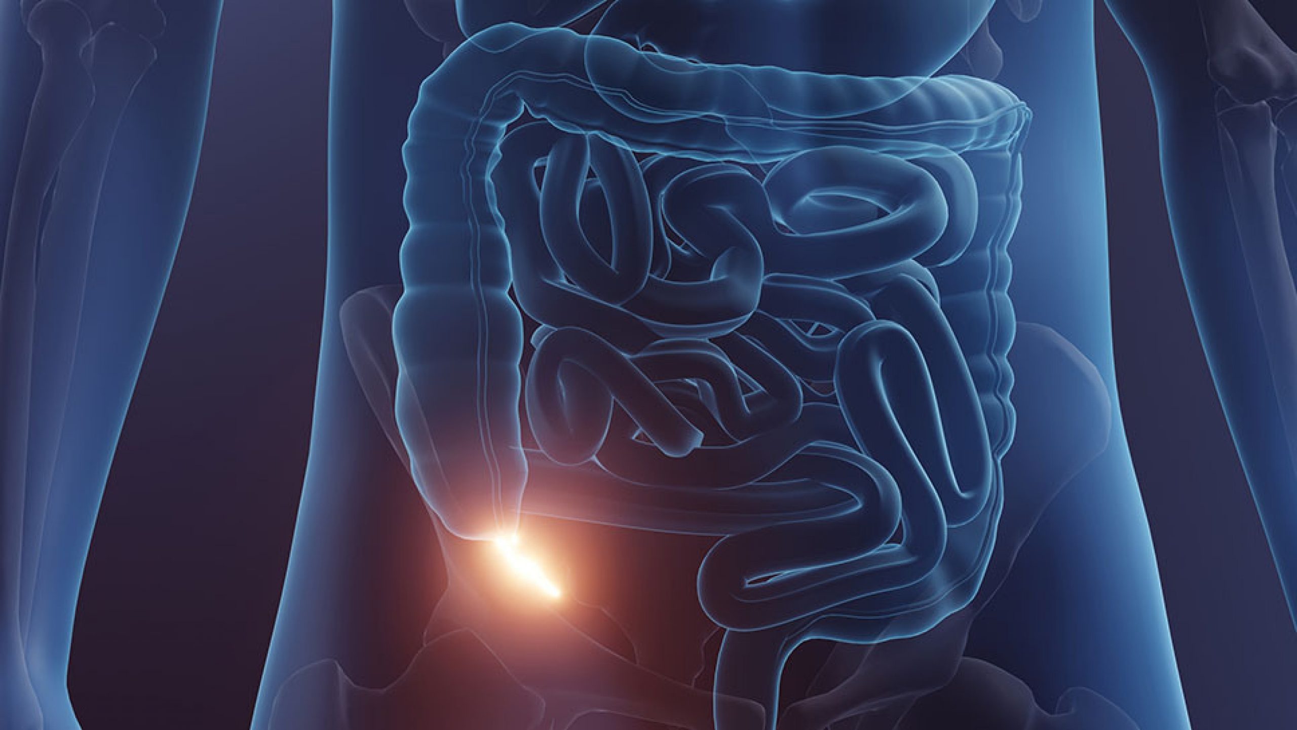 Early Preoperative Antibiotics Before Appendectomy | Clinician.com