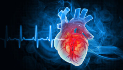 Afib Getty Images 2223338895