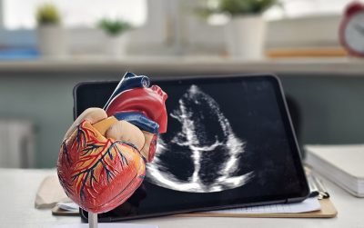 Echocardiography Getty Images 2194245609