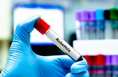 Rickettsia blood sample tube Getty Images 2170783993