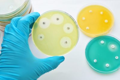 Antibiotic susceptibility testing Getty Images 542317090