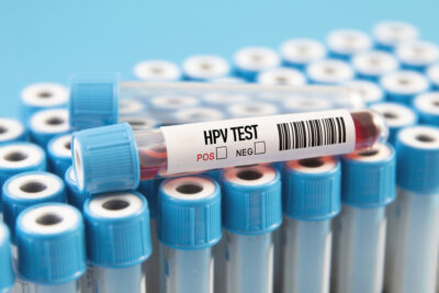 Hpv test Getty Images 1462081351