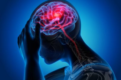 Stroke illustration Getty Images 1168179082