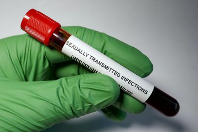 STI sample Getty Images 959020230