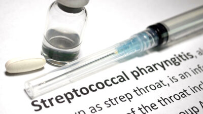 Streptococcal pharyngitis Getty Images 827804200