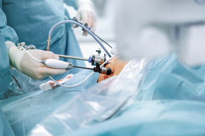 Bariatric Surgery