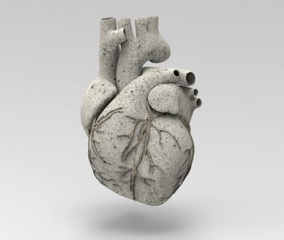 Coronary calcium Getty Images 955545326