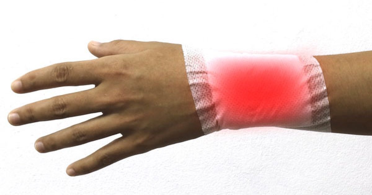 Outbreak: A Bad Bug in a Burn Unit | Clinician.com