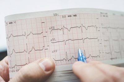 Doctor examining ECG Getty Images 1264072162