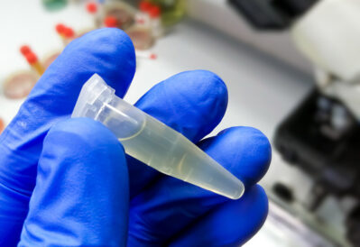 CSF sample Getty Images 1400732853