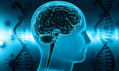 Viral brain infection illustration Getty Images 1265550775