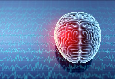 Brain activity Getty Images 938046810