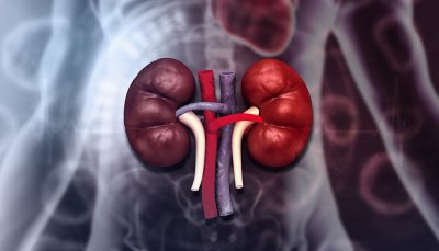 CKD Getty Images 1790769781