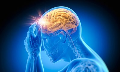 Stroke medical illustration Getty Images 2170475407