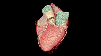 CTA heart Getty Images 1150233857