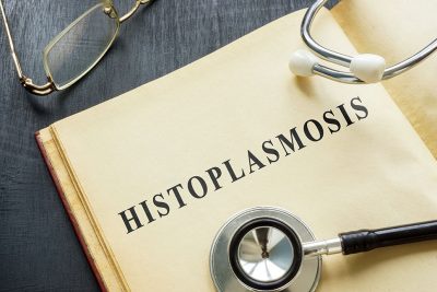 Histoplasmosis Getty Images 1385751508