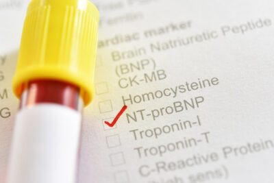 N Tpro BNP Getty Images 1170736047