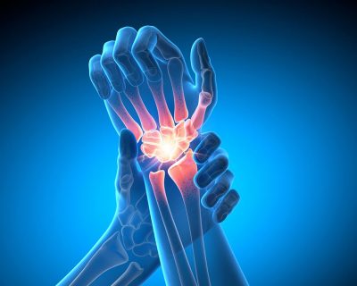 Wrist injury Getty Images 2166054405