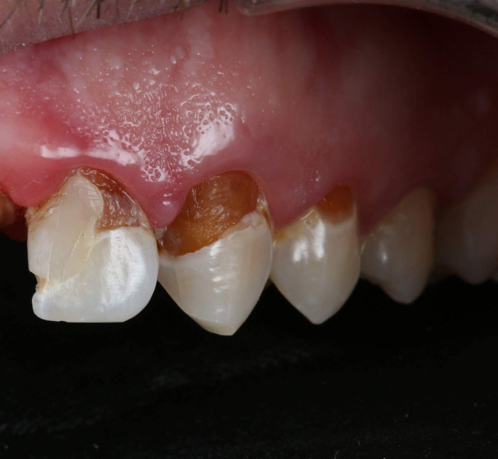 PCR 100125 Figure 14