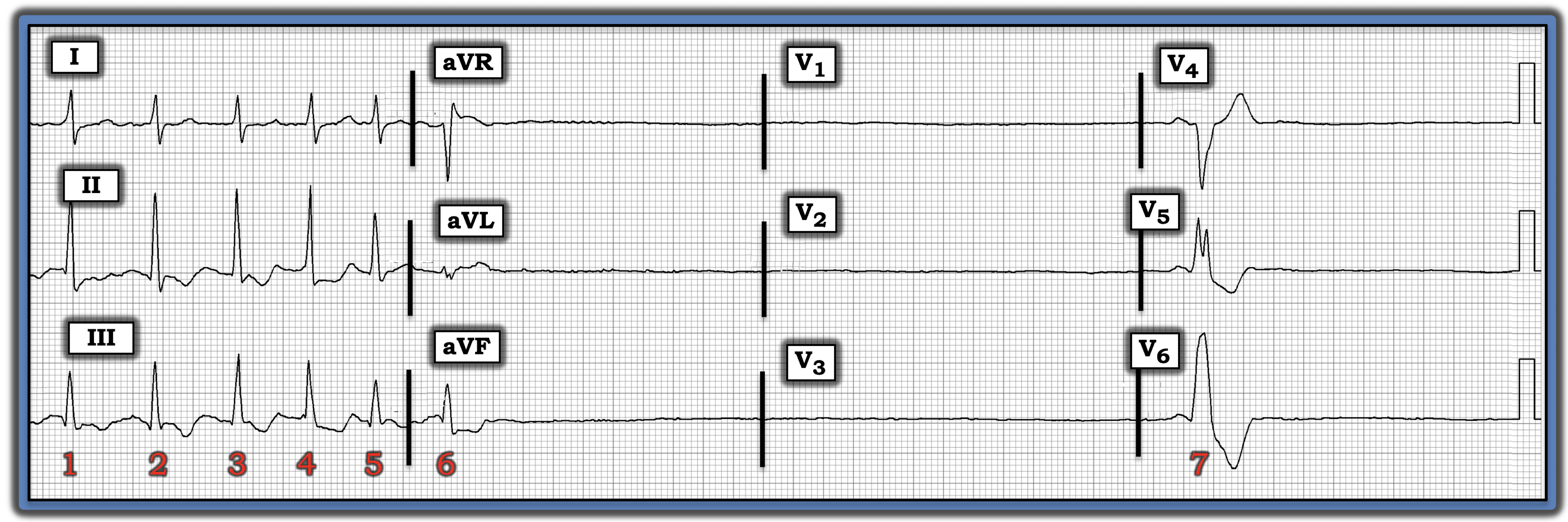 IM 021524 ECG Review