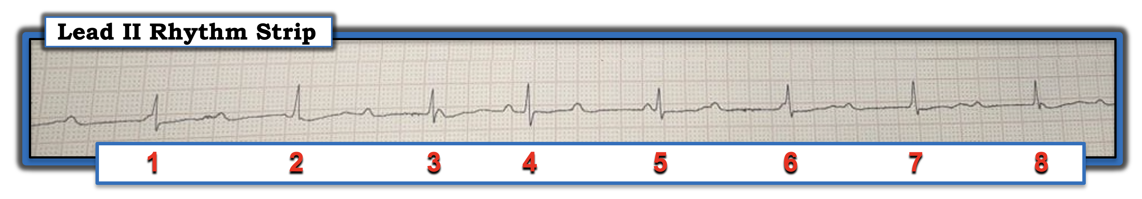 September 15, 2023, IM ECG Review Figure